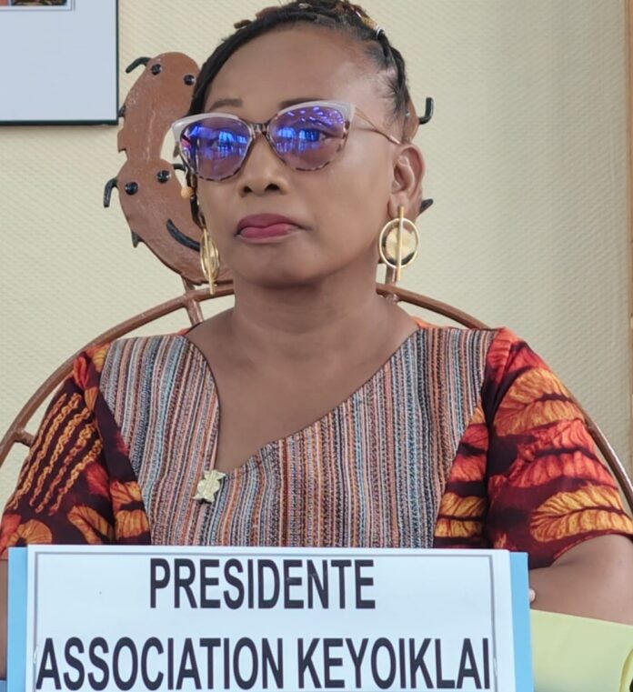 Burkina-Albinisme